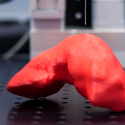 3D printed liver based on CT images