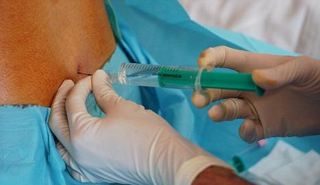 Epidural steroid injection during pregnancy